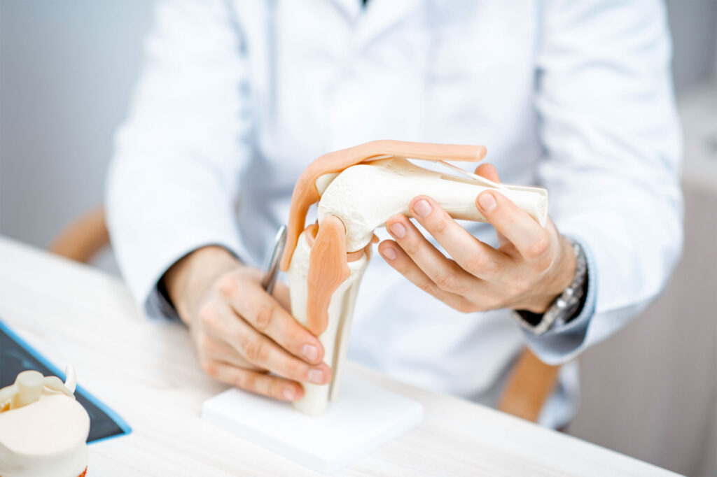 Orthopedic medical device manufacturing - knee joint model